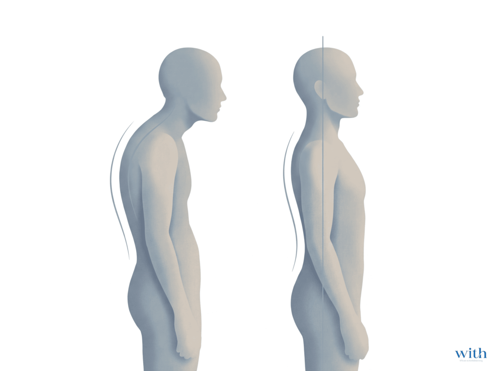背中が丸まり頭が前に出た猫背姿勢と理想的な姿勢を比較した模式図