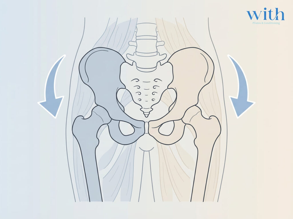 骨盤の左右差を示す姿勢の模式図