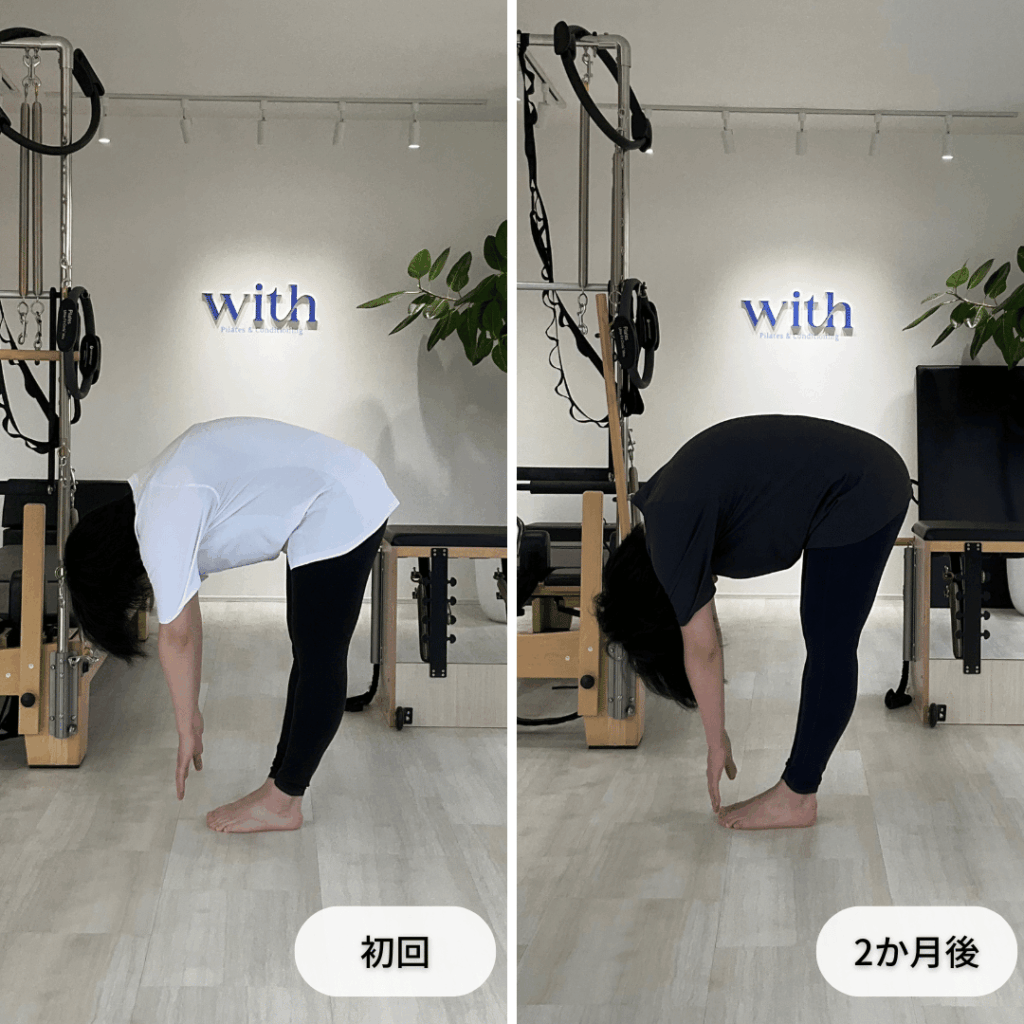 初回と2か月後の前屈動作を側面から比較した写真